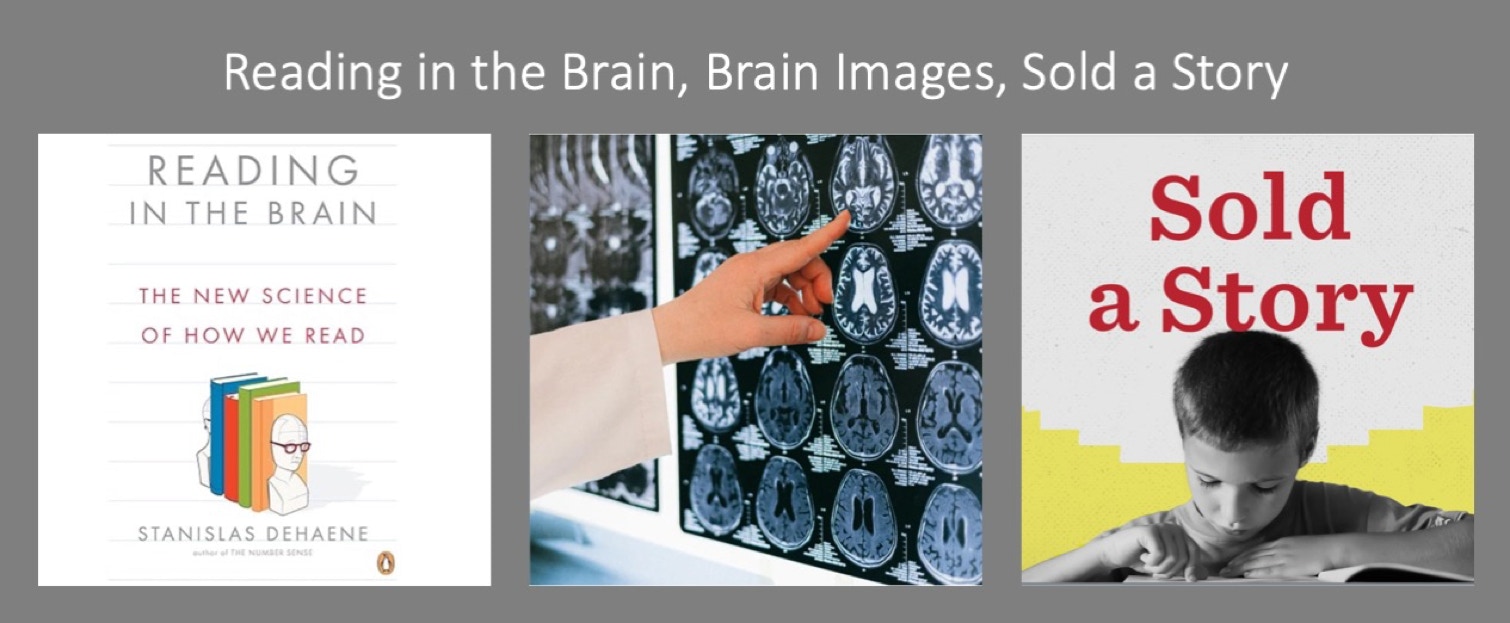 Reading in the Brain, Brain Images,Sold A Story